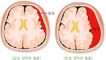 ޼ 渷.jpg